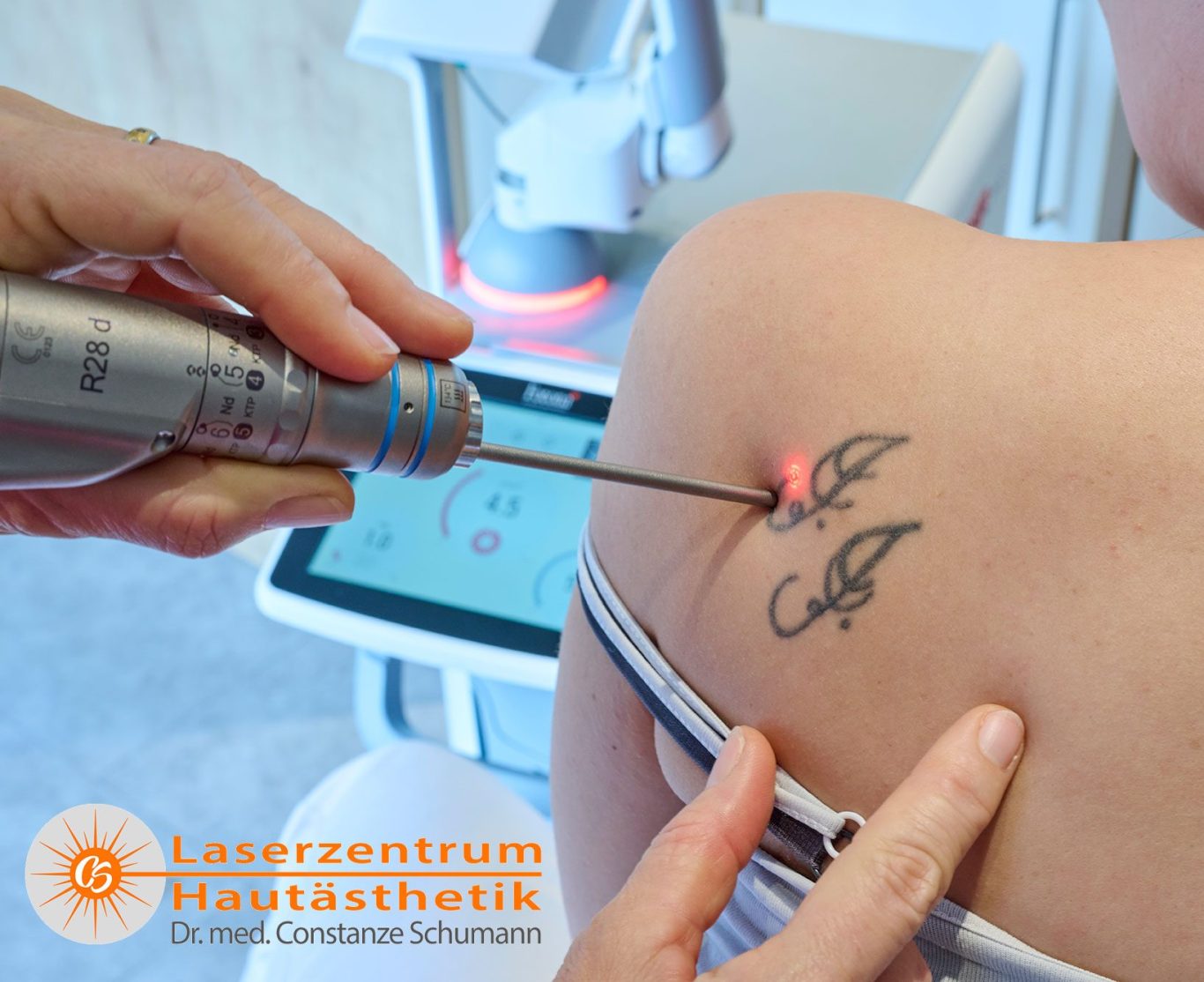 Picosekundenlaser Tattoo weglasern in Straubing Picosekundenlaser Tattoo weglasern in Straubing