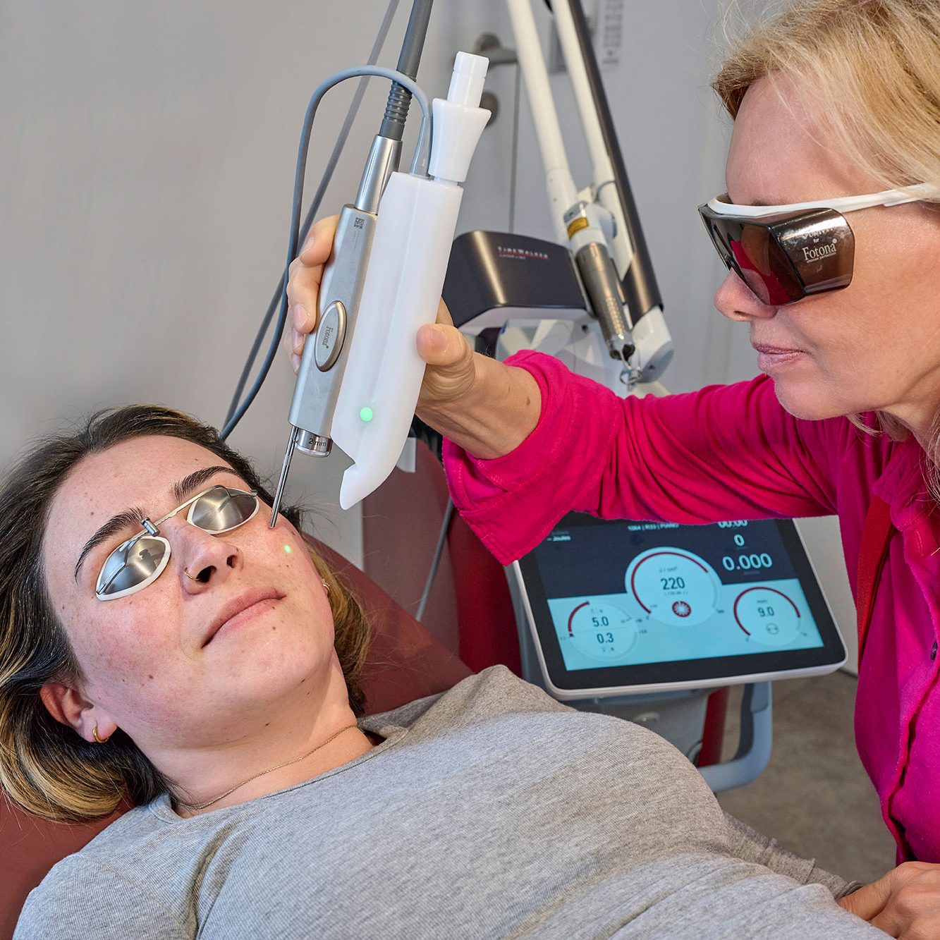 Laserbehandlung mit TimeWalker Fotona4D im Gesicht - Laserzentrum Hautästhetik Straubing