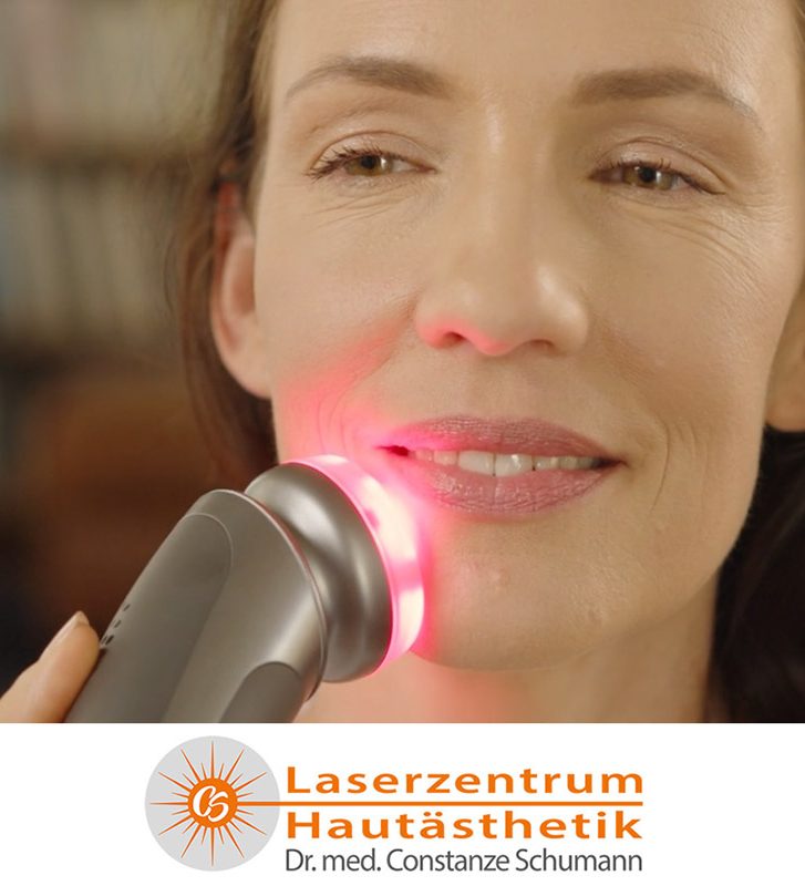 XERF Hautstraffung Laserzentrum Straubing mit Genesis Prime