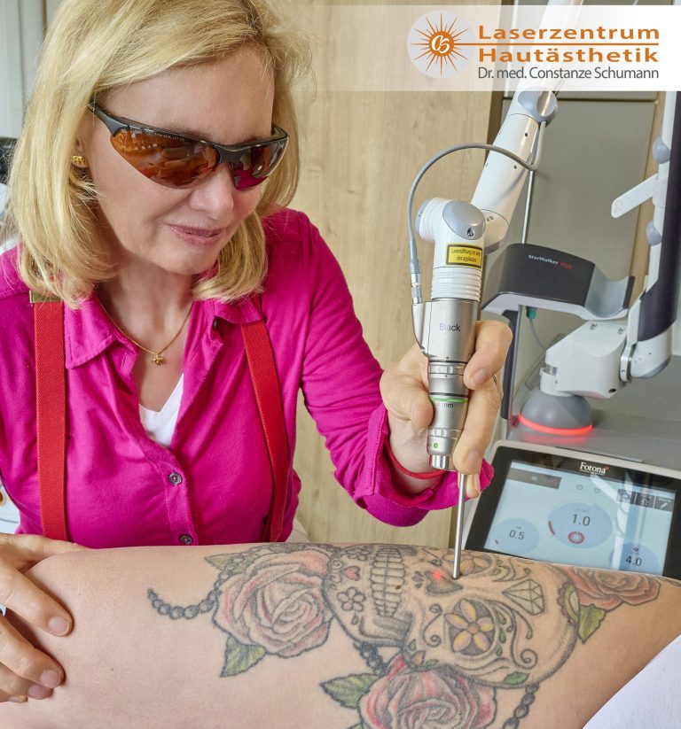 Laserzentrum Straubing Tattoo Entfernung Picosekunden Laser Laserzentrum Straubing Tattoo Entfernung Picosekunden Laser